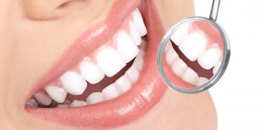 Estetica Dentale